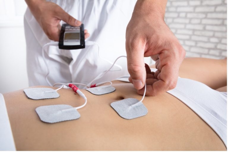 Close-up of a therapist’s hand placing electrodes on a woman’s stomach for gastric electrical stimulation to treat her Gastroparesis